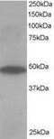 RP1 Axonemal Microtubule Associated antibody, PA1-31014, Invitrogen Antibodies, Western Blot image 