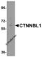 Catenin Beta Like 1 antibody, 6215, ProSci, Western Blot image 