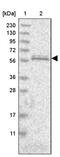 Mitochondrial Calcium Uptake Family Member 3 antibody, PA5-55180, Invitrogen Antibodies, Western Blot image 