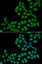 Ephrin A2 antibody, STJ28984, St John