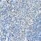 Nuclear Receptor Corepressor 2 antibody, GTX66517, GeneTex, Immunohistochemistry paraffin image 