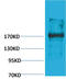 Ectopic P-Granules Autophagy Protein 5 Homolog antibody, STJ97392, St John