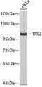 TPX2 Microtubule Nucleation Factor antibody, 19-404, ProSci, Western Blot image 
