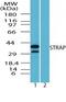 Serine-threonine kinase receptor-associated protein antibody, PA5-23165, Invitrogen Antibodies, Western Blot image 