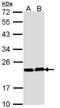 Calcineurin Like EF-Hand Protein 1 antibody, GTX113936, GeneTex, Western Blot image 