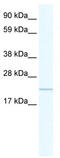 Cilia And Flagella Associated Protein 20 antibody, TA335646, Origene, Western Blot image 