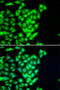 DNA repair protein RAD51 homolog 2 antibody, STJ29042, St John
