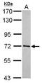 E3 ubiquitin-protein ligase TRIM41 antibody, GTX120602, GeneTex, Western Blot image 