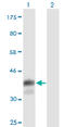 CD5 Molecule antibody, LS-C196841, Lifespan Biosciences, Western Blot image 