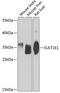 Sulfotransferase Family 1E Member 1 antibody, GTX65828, GeneTex, Western Blot image 