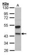 Kininogen LC antibody, orb74152, Biorbyt, Western Blot image 