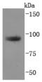 Trans-Golgi Network Protein 2 antibody, A06591, Boster Biological Technology, Western Blot image 