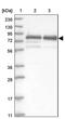 DDB1 And CUL4 Associated Factor 8 antibody, PA5-55594, Invitrogen Antibodies, Western Blot image 