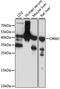 ORM1 antibody, GTX54601, GeneTex, Western Blot image 