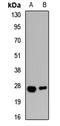 Aquaporin-8 antibody, orb412777, Biorbyt, Western Blot image 