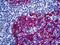 Keratin 5 antibody, orb94443, Biorbyt, Immunohistochemistry paraffin image 