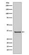 Cyclin-H antibody, M03013, Boster Biological Technology, Western Blot image 