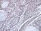 FA Complementation Group D2 antibody, PA5-30592, Invitrogen Antibodies, Immunohistochemistry paraffin image 