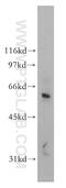 DNA Cross-Link Repair 1B antibody, 13203-1-AP, Proteintech Group, Western Blot image 