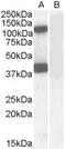 Erythrocyte Membrane Protein Band 4.1 Like 2 antibody, EB08135, Everest Biotech, Western Blot image 