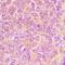 Akt antibody, orb304680, Biorbyt, Immunohistochemistry paraffin image 