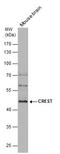 SS18L1 Subunit Of BAF Chromatin Remodeling Complex antibody, GTX115986, GeneTex, Western Blot image 