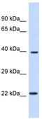 Aryl Hydrocarbon Receptor Nuclear Translocator 2 antibody, TA343757, Origene, Western Blot image 
