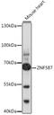 Zinc Finger Protein 587 antibody, 16-460, ProSci, Western Blot image 