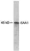 Serum Amyloid A1 antibody, LS-C202982, Lifespan Biosciences, Western Blot image 