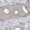 Chromosome 21 Open Reading Frame 58 antibody, HPA035111, Atlas Antibodies, Immunohistochemistry paraffin image 