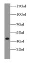 Death Associated Protein Kinase 2 antibody, FNab02241, FineTest, Western Blot image 