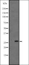 Fibroblast Growth Factor 12 antibody, orb335303, Biorbyt, Western Blot image 