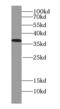 Plasminogen Activator, Urokinase Receptor antibody, FNab09268, FineTest, Western Blot image 