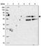 RNA Exonuclease 5 antibody, PA5-59333, Invitrogen Antibodies, Western Blot image 