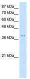 Protein arginine N-methyltransferase 1 antibody, TA345680, Origene, Western Blot image 