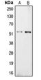 P21 (RAC1) Activated Kinase 5 antibody, orb215241, Biorbyt, Western Blot image 