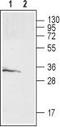 Galanin Receptor 3 antibody, TA328851, Origene, Western Blot image 