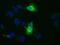 Aminoacylproline aminopeptidase antibody, MA5-25168, Invitrogen Antibodies, Immunocytochemistry image 