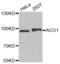 Aconitase 1 antibody, abx004618, Abbexa, Western Blot image 