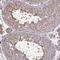 Annexin A5 antibody, HPA035330, Atlas Antibodies, Immunohistochemistry paraffin image 