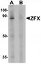 Zinc finger X-chromosomal protein antibody, TA319738, Origene, Western Blot image 