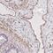 Ring Finger Protein 103 antibody, NBP2-31700, Novus Biologicals, Immunohistochemistry paraffin image 
