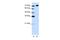 A-Kinase Anchoring Protein 8 Like antibody, A07444, Boster Biological Technology, Western Blot image 