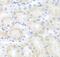 Adiponectin, C1Q And Collagen Domain Containing antibody, FNab09814, FineTest, Immunohistochemistry paraffin image 