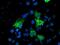 Potassium Voltage-Gated Channel Subfamily A Member Regulatory Beta Subunit 1 antibody, MA5-25789, Invitrogen Antibodies, Immunocytochemistry image 