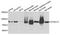 Cytoplasmic dynein 1 intermediate chain 1 antibody, A3833, ABclonal Technology, Western Blot image 