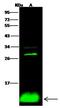 S100 Calcium Binding Protein A2 antibody, GTX02523, GeneTex, Western Blot image 