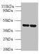 Arginine Vasopressin Receptor 1B antibody, A53413-100, Epigentek, Western Blot image 