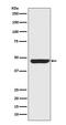 Keratin 20 antibody, M02828, Boster Biological Technology, Western Blot image 