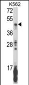 Killer cell immunoglobulin-like receptor 2DL5B antibody, PA5-72596, Invitrogen Antibodies, Western Blot image 